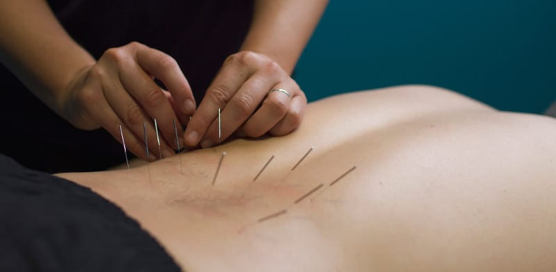 needle therapy for pain
